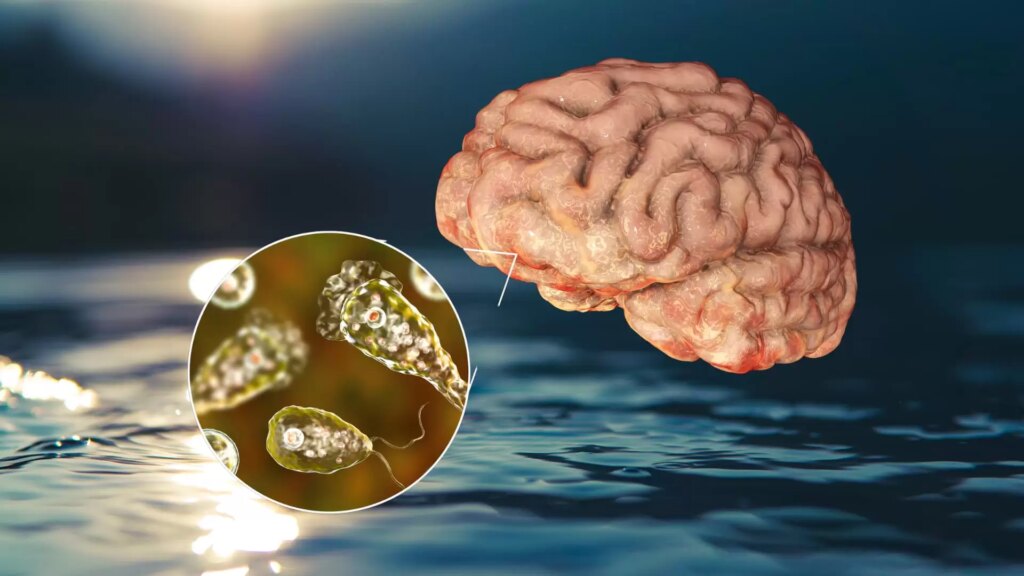 bizarro em acao ameba comedora de cerebro nos eua causa fatalidade