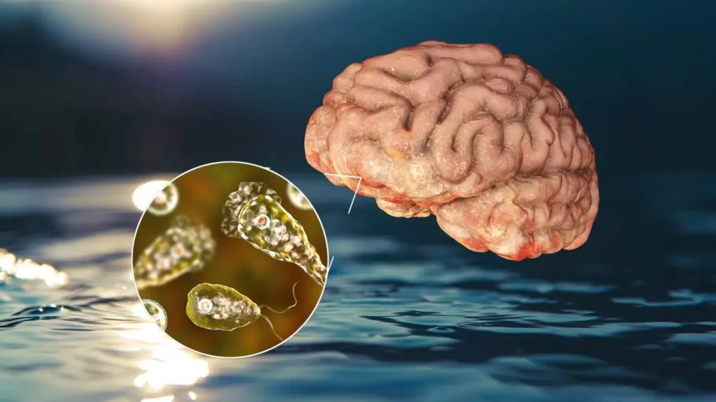Bizarro em ação: Ameba comedora de cérebro nos EUA causa fatalidade 19 bizarro em acao ameba comedora de cerebro nos eua causa fatalidade