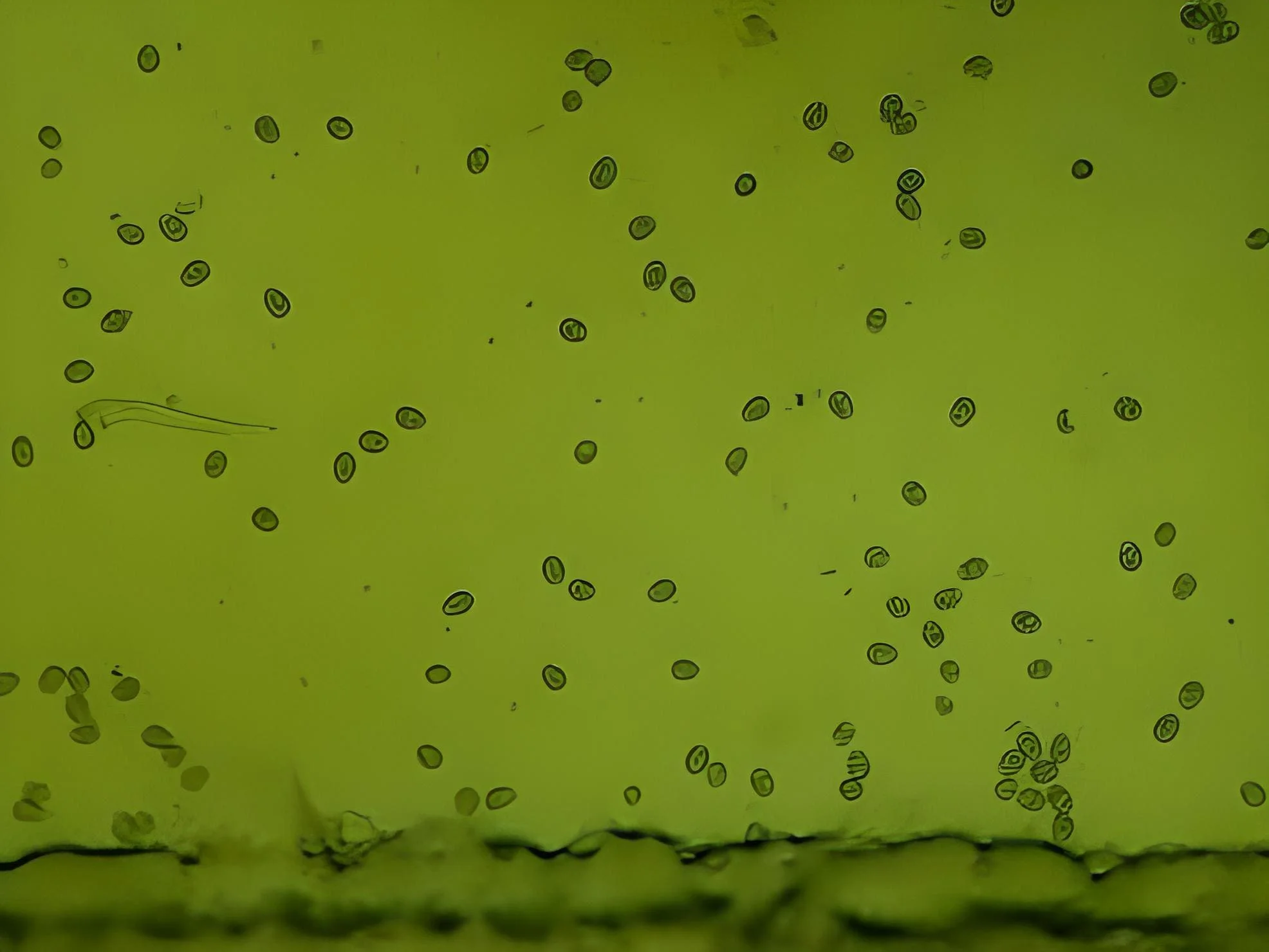 Enxaqueca: Sintomas e Tratamento 24 o que é, principais sintomas e tratamento