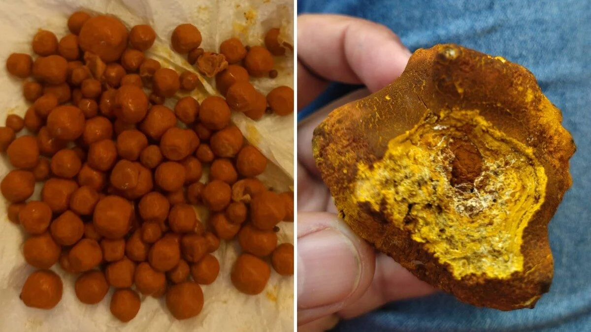 'Pedra preciosa' encontrada na vesícula dos bois custa R$ 3 milhões o quilo; conheça | Pecuária