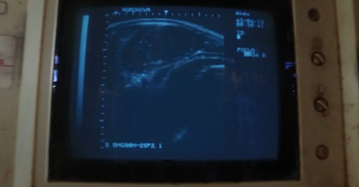 Descubra o impacto da ultrassonografia na pecuária! 5 Ultrassonografia de carcaça: saiba como a ferramenta transformou a pecuária brasileira